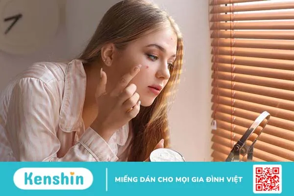 Loại mụn nào có thể nặn? Thế nào là cách nặn mụn đúng cách 3