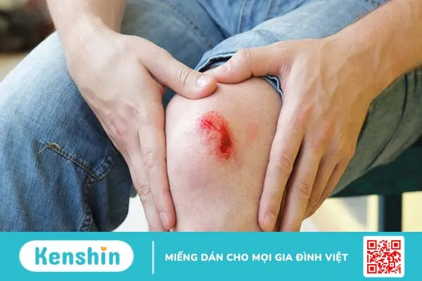 Thiếu yếu tố V: Triệu chứng, nguyên nhân, chuẩn đoán và điều trị 1