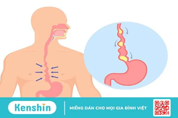 Thủng thực quản rất nguy hiểm bạn có biết? -1