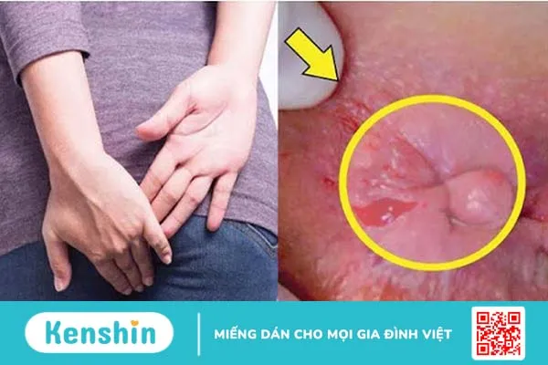 Thuốc Tottri có tốt và hiệu quả không? 3