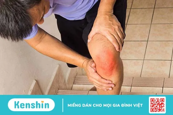 Tiêm gân: chỉ định thực hiện, ưu điểm, quy trình tiến hành 3