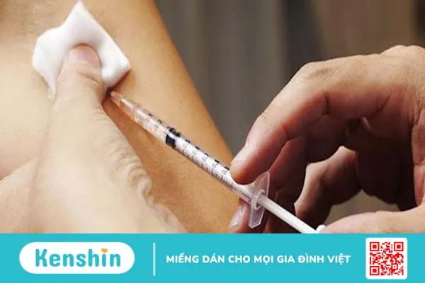 Tiêm phòng dại không đúng lịch có ảnh hưởng gì không? 4