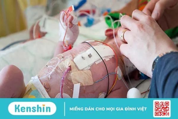 Tìm hiểu chi tiết về dị tật bẩm sinh tâm thất độc nhất 4