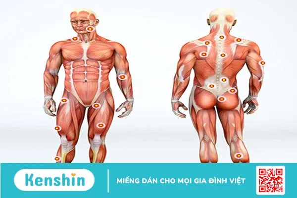 Tìm hiểu chung về Trigger Point và các phương pháp điều trị 1