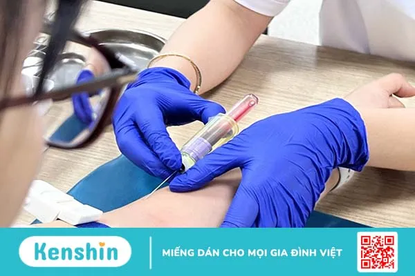 Tìm hiểu khái niệm bổ thể C3 và C4 là gì? Vai trò của xét nghiệm bổ thể C3 và C4 3