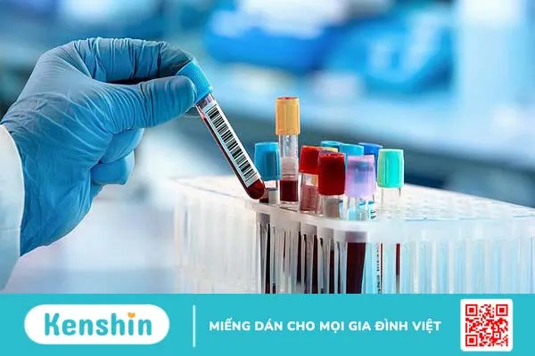 Tìm hiểu khái niệm bổ thể C3 và C4 là gì? Vai trò của xét nghiệm bổ thể C3 và C4 4