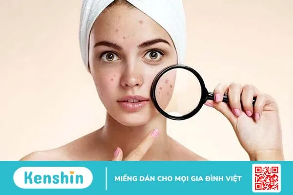 Tìm hiểu nguyên nhân dùng sữa rửa mặt bị nổi mụn 1