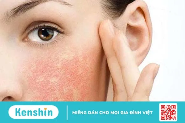 Tìm hiểu nguyên nhân dùng sữa rửa mặt bị nổi mụn 3