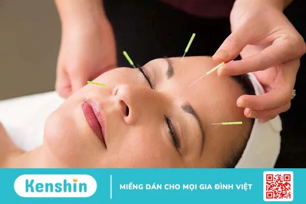 Tai biến méo miệng do liệt dây thần kinh số 7 4