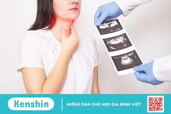 Tìm hiểu về bướu giáp và phân độ bướu giáp 3