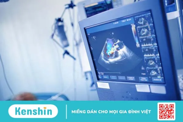 Tìm hiểu về các chỉ số đánh giá chức năng của tim 3