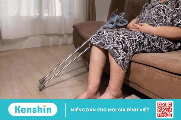 Tìm hiểu về các phân độ phù, nguyên nhân và cách điều trị 1