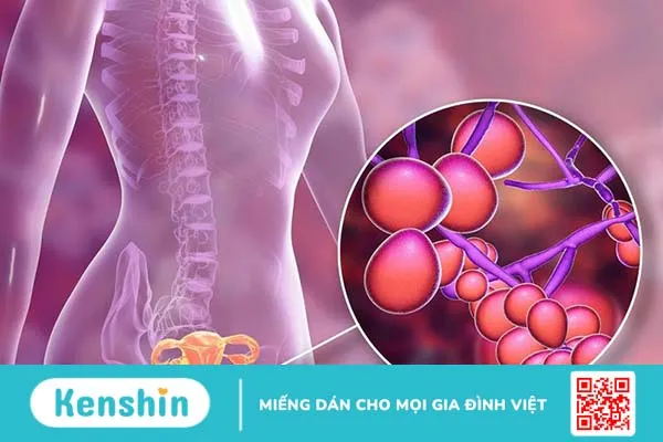 Tìm hiểu về đặc điểm của Gardnerella là gì. Gardnerella gây ra những biến chứng gì? 2