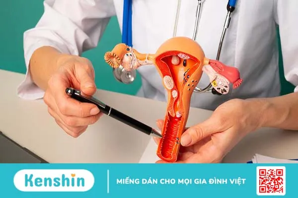 Tìm hiểu về dị dạng sinh dục nữ 4