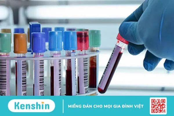 Tìm hiểu xét nghiệm GPB là gì? Vai trò quan trọng của xét nghiệm GPB 1