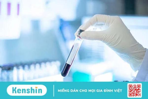 Tìm hiểu xét nghiệm GPB là gì? Vai trò quan trọng của xét nghiệm GPB 2