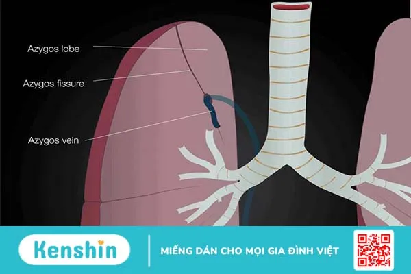 Tĩnh mạch Azygos có vai trò gì? Bệnh lý liên quan đến tĩnh mạch Azygos 1