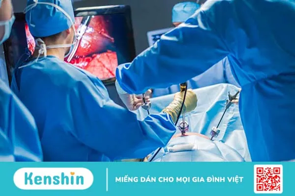 Tổng quan về phương pháp mổ nội soi điều trị thoát vị bẹn 1