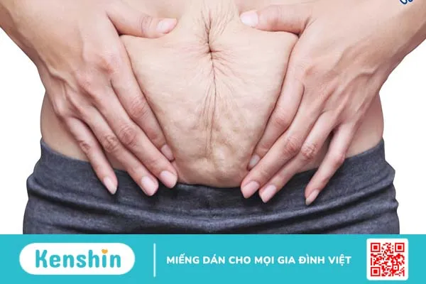 kem rạn da sau sinh của nhật 1