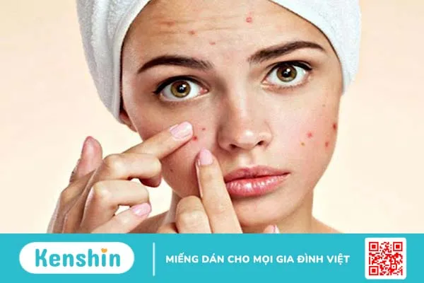 Gel dưỡng ẩm La Roche Posay Effaclar Duo+ Unifiant là sản phẩm dưỡng ẩm phù hợp với làn da dầu hay da nhiều mụn