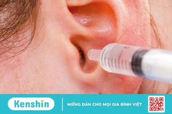 Trẻ có nhiều ráy tai phải làm sao? 4