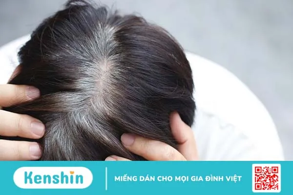 Trẻ em tóc bạc sớm khám ở đâu? Gợi ý những địa chỉ uy tín tại Hà Nội và TP.HCM 1