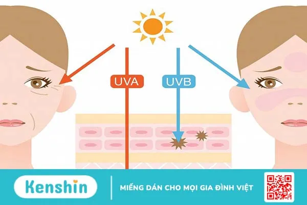 Trị đồi mồi sau sinh như thế nào? 2