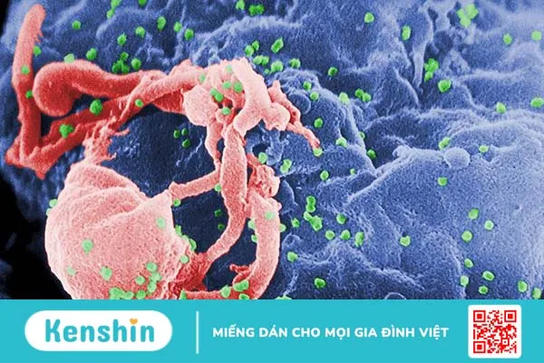 Triệu chứng HIV sau 4 năm như thế nào? Điều trị ra sao? 1