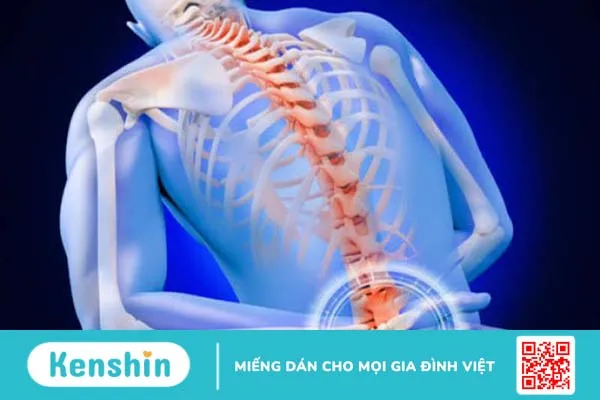 Trượt đốt sống thắt lưng và những điều người bệnh cần chú ý 2