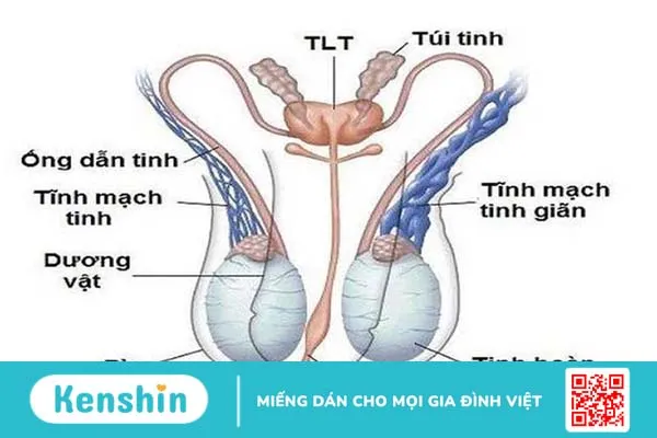 Túi giãn tĩnh mạch bìu là gì? Nguyên nhân và phương pháp điều trị 1