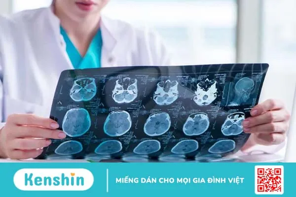 Người bệnh bị u tuyến yên có nên mổ không? Lợi ích và rủi ro khi phẫu thuật u tuyến yên 2