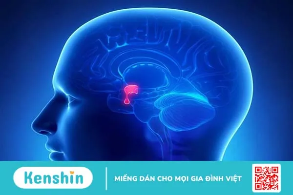 Người bệnh bị u tuyến yên có nên mổ không? Lợi ích và rủi ro khi phẫu thuật u tuyến yên 3