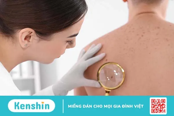 U xơ dưới da là gì? Cách phân biệt với u mỡ dưới da 1