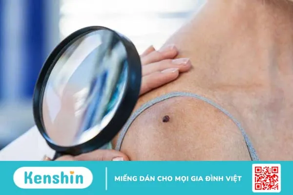 U xơ dưới da là gì? Cách phân biệt với u mỡ dưới da 1