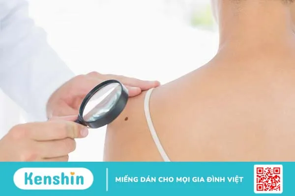 U xơ dưới da là gì? Cách phân biệt với u mỡ dưới da 3