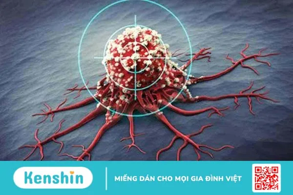 U xơ thần kinh mụn thịt là gì? Những thông tin cần biết 1