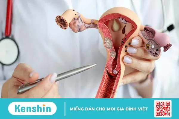 U xơ tử cung 86mm có nguy hiểm không? Phương án điều trị u xơ tử cung kích thước lớn 3