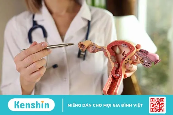 U xơ tử cung dưới niêm mạc nguy hiểm như thế nào? Có chữa được không? 3