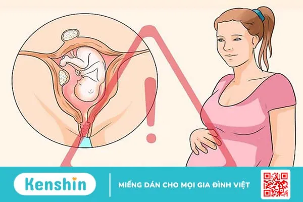 U xơ tử cung khi mang thai phải làm gì? 2