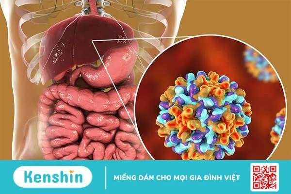 Nhiễm viêm gan siêu vi B khi còn nhỏ là nguyên nhân gây ung thư gan