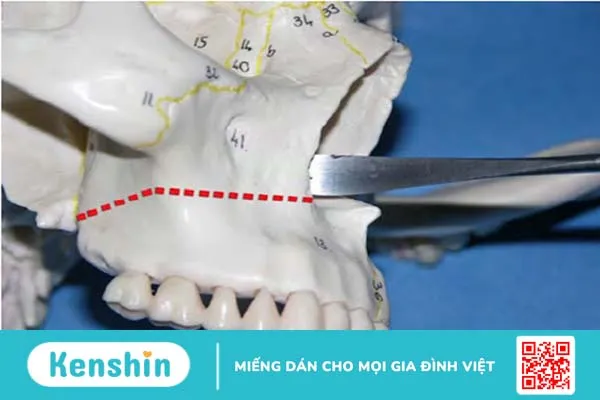 Ung thư miệng và hầu họng: Lựa chọn điều trị 2