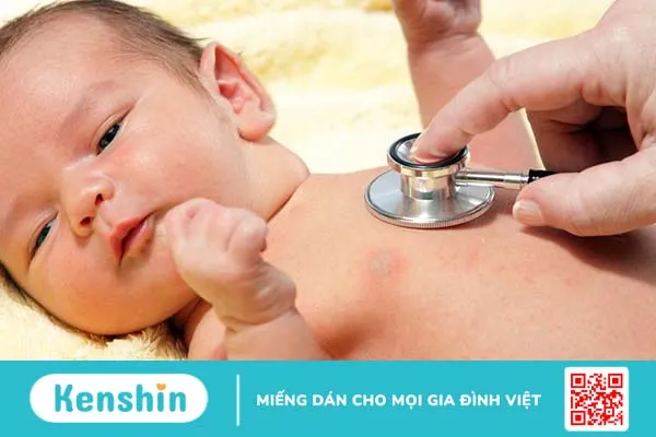 Vàng da do thiếu hụt citrin: Nguyên nhân và điều trị 4