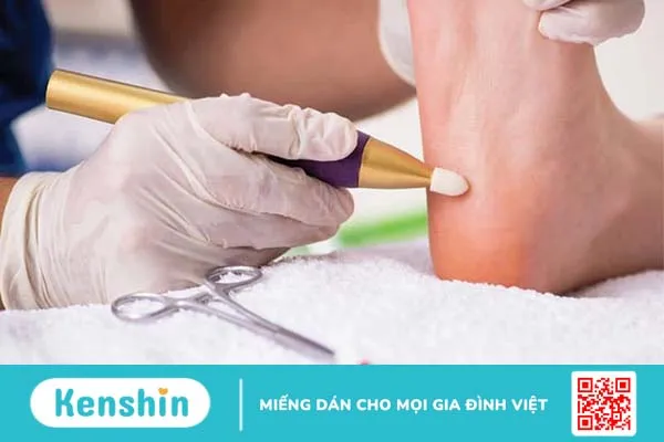 Viêm cân gan chân bao lâu thì khỏi ? Bệnh viện nào tại TPHCM có thể điều trị viêm cân gan chân lâu năm 3