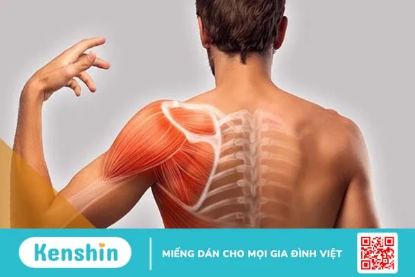 Viêm cơ lan tỏa: Nguyên nhân, triệu chứng và cách điều trị bệnh hiệu quả 1