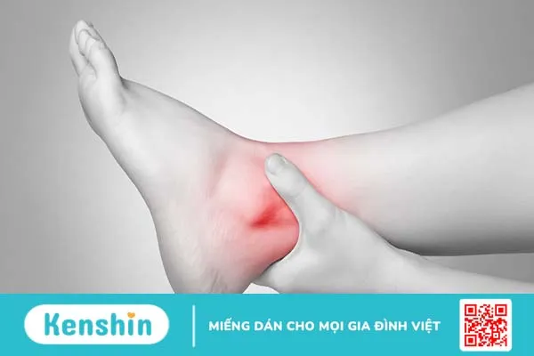 Viêm cơ lan tỏa: Nguyên nhân, triệu chứng và cách điều trị bệnh hiệu quả 2