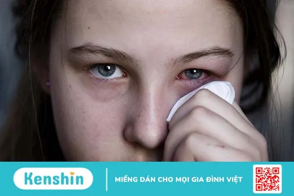 Viêm dây thần kinh mắt có nguy hiểm không? Cách chẩn đoán và điều trị bệnh thế nào? 1