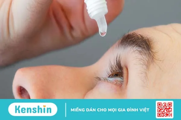 Viêm giác mạc dùng thuốc gì? 3