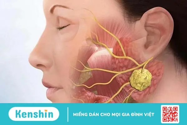 Viêm khớp thái dương hàm: Nguyên nhân và cách điều trị 1