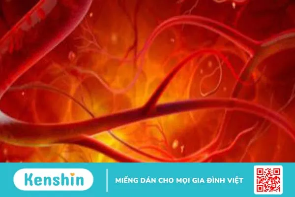 Viêm mạch máu là gì? Nguyên nhân và cách điều trị bệnh 3