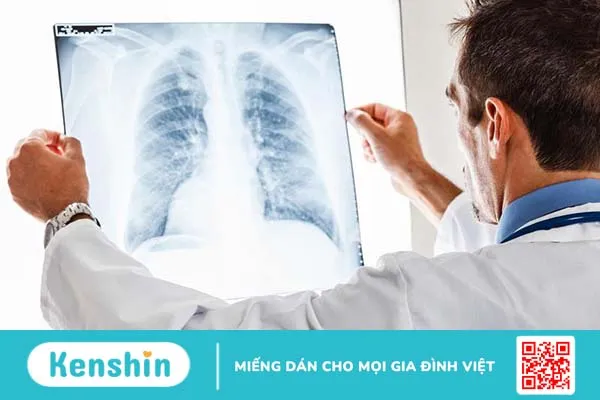 Viêm phế quản cấp: Giải đáp các câu hỏi thường gặp cùng bác sĩ 3